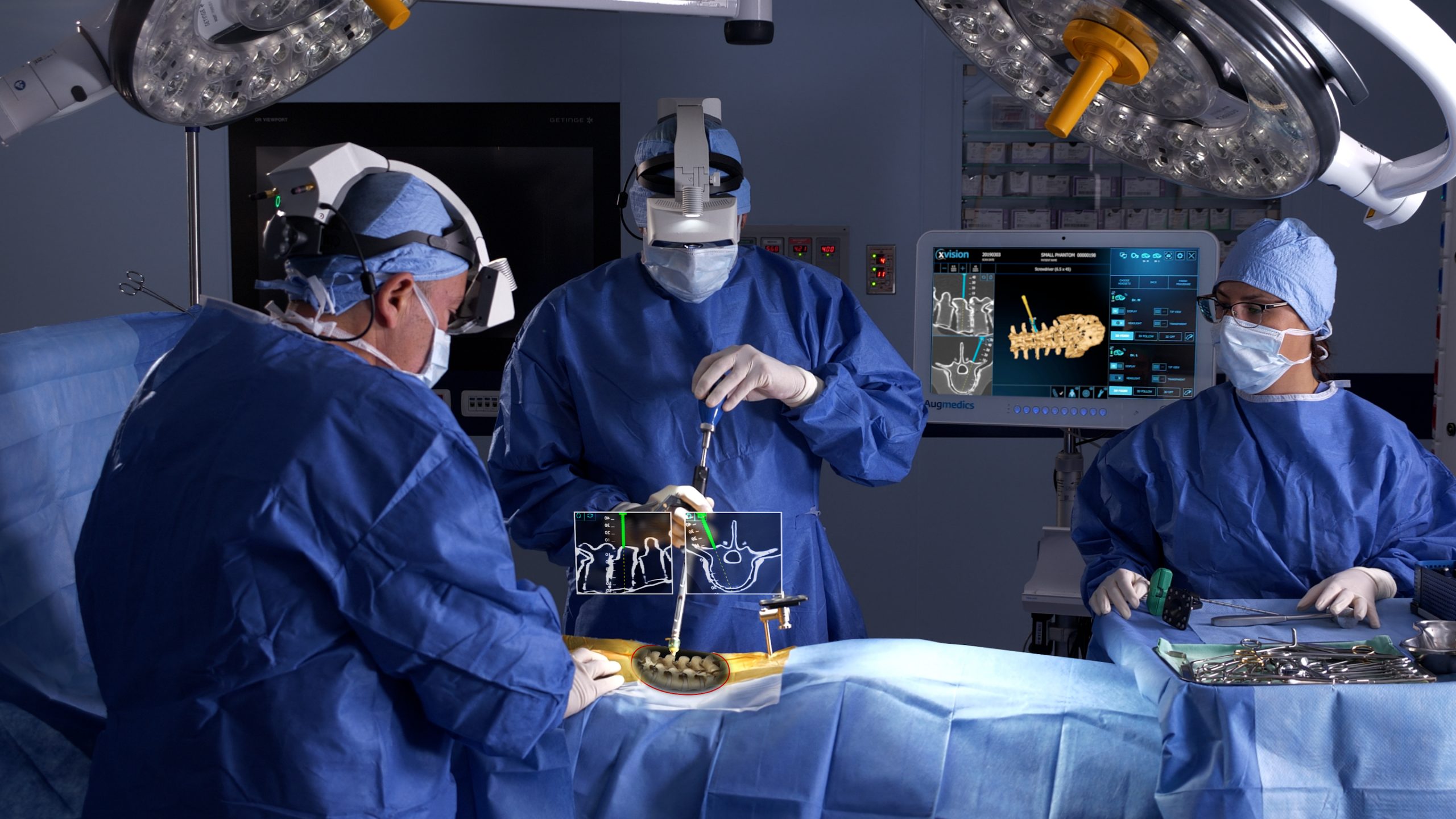 Surgical Procedure for Spinal Implants