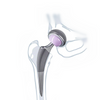 Cementless Semi hip System