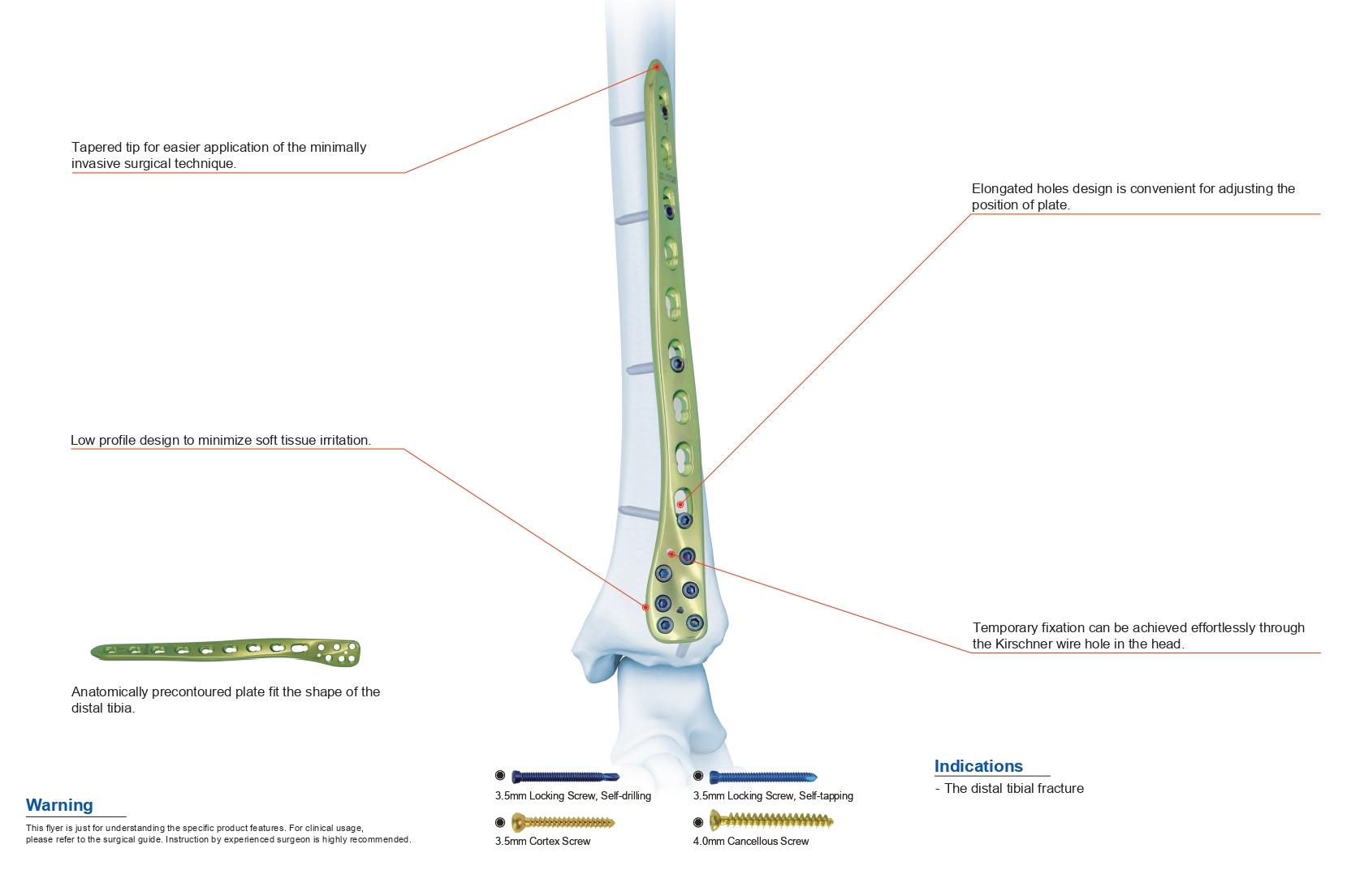 Distal Medial Tibial Locking Plate