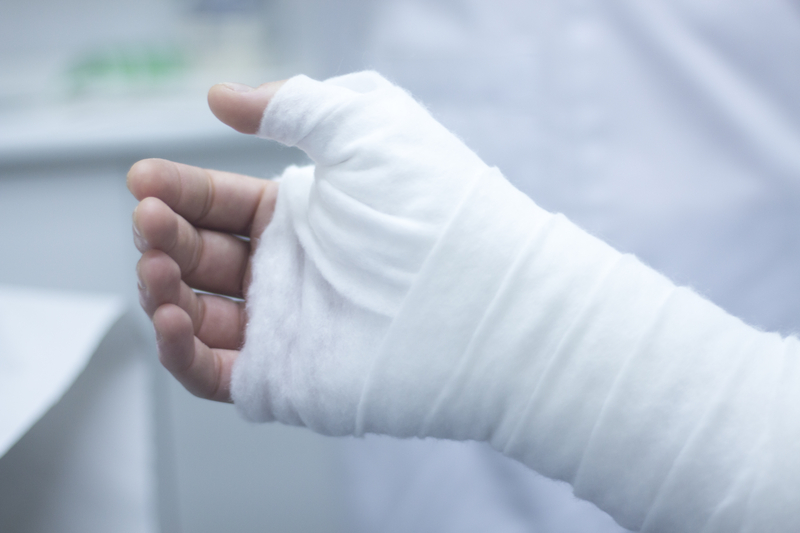 Metacarpal locking plates