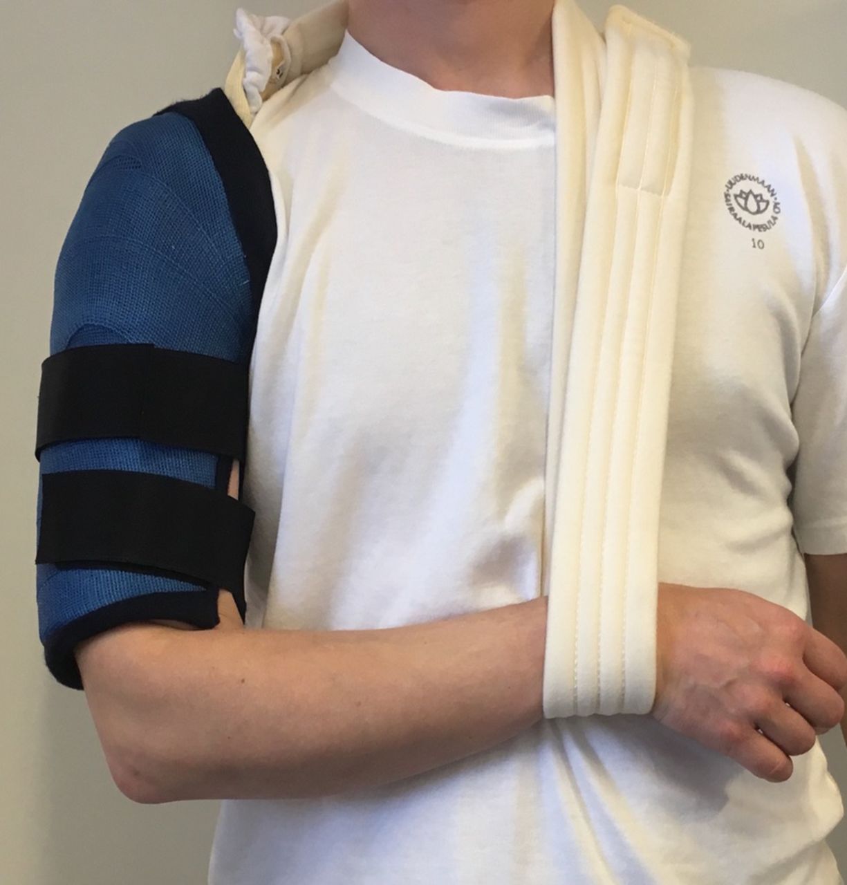 Proximal Humeral Locking Plate