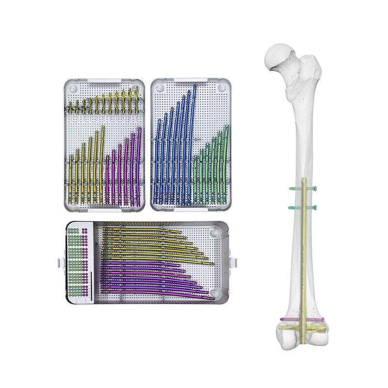 DFN Intramedullary Nail Box 1000-0135