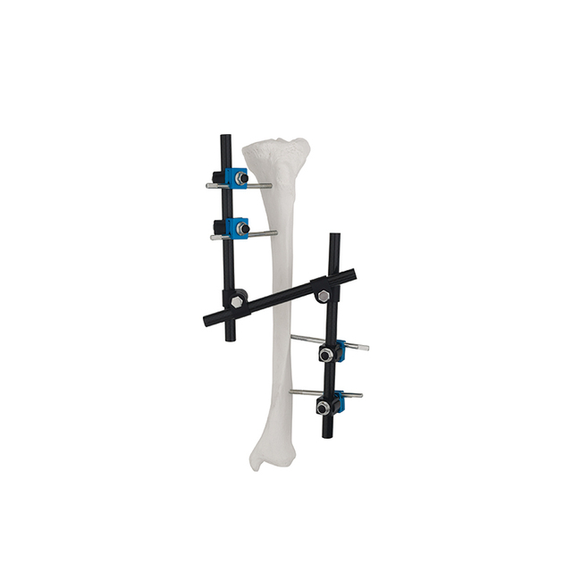 Z Type(Enhancement Mode) External Fixator