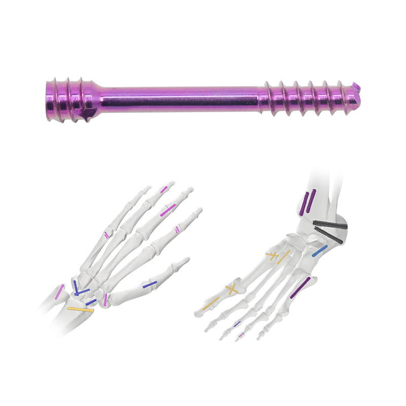 Herbert Cannulated Compression Screw