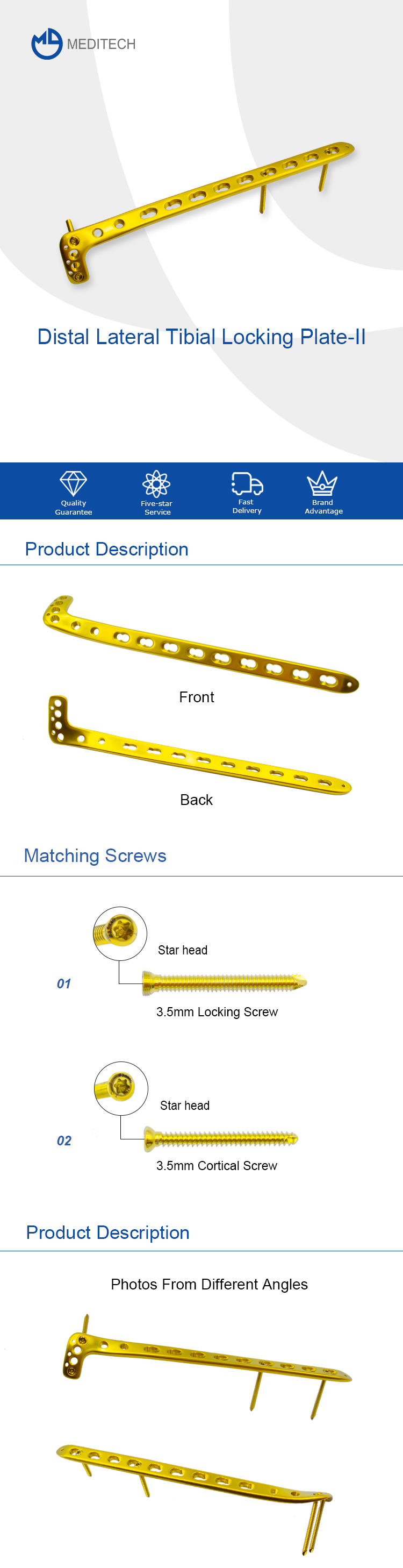 Proximal Lateral Tibial Locking Plate