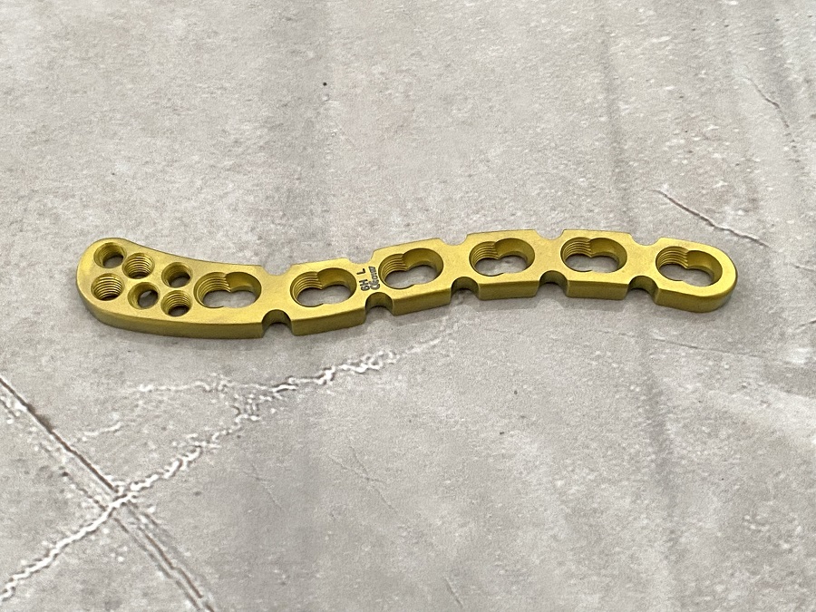 Piastra di bloccaggio clavicolare distale
