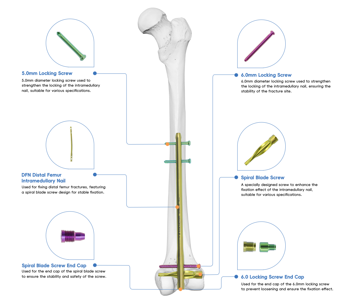 DFN Distal Femur Intramedullary Nail 