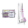 Distal Tibial Intramedullary Nail (DTN) Instrument Box 1000-0139