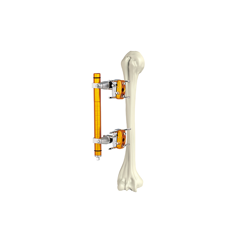 Humerus External Fixator