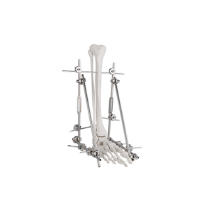 Fackle Ackle Fook Poftor 9100-2401