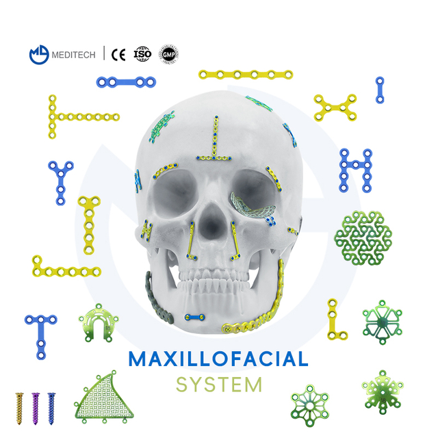 Maxillofacial Plate 1.5mm oo is-qodida