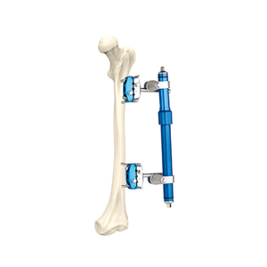 Micro-motion Type External Fixator 7100-20