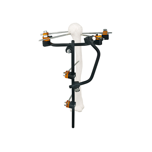 Condylar External Fixator