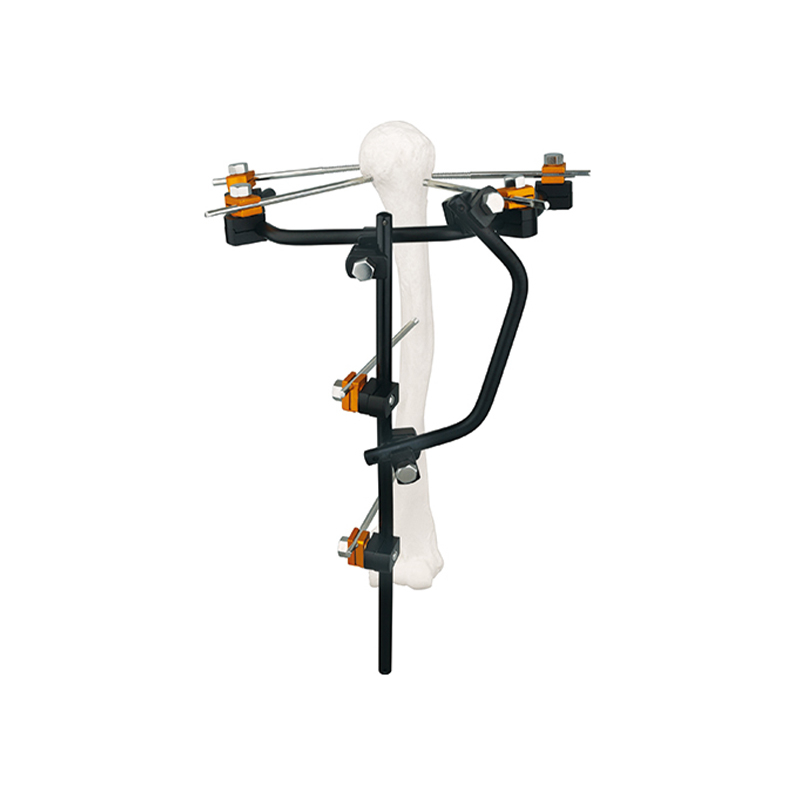 Condylar External Fixator