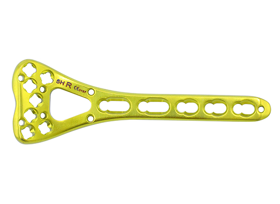 Distal Radius Fracture Surgery in Mexico &mdash; Using CZMEDITECH VA Locking Plate System5