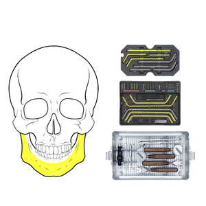 2.4mm Maxillofacial Plate System