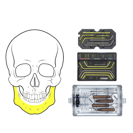 2.4mm Maxillofacial Plate System