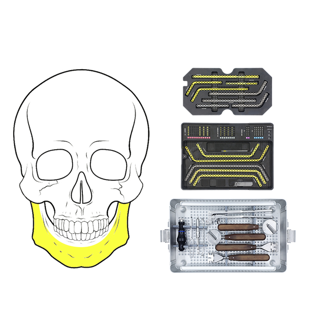 2.4mm Maxillofacial Plate System
