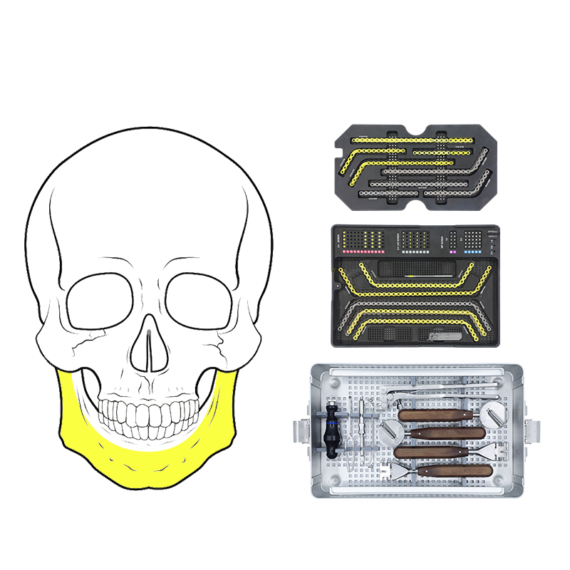 2.4mm Maxillofacial Plate System