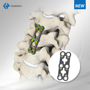 Anterior sevikal spayna fikseshɔn sistem .