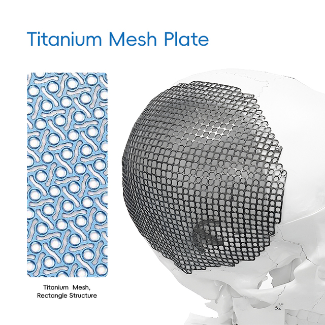 Titanium Mesh Rectangle Structure