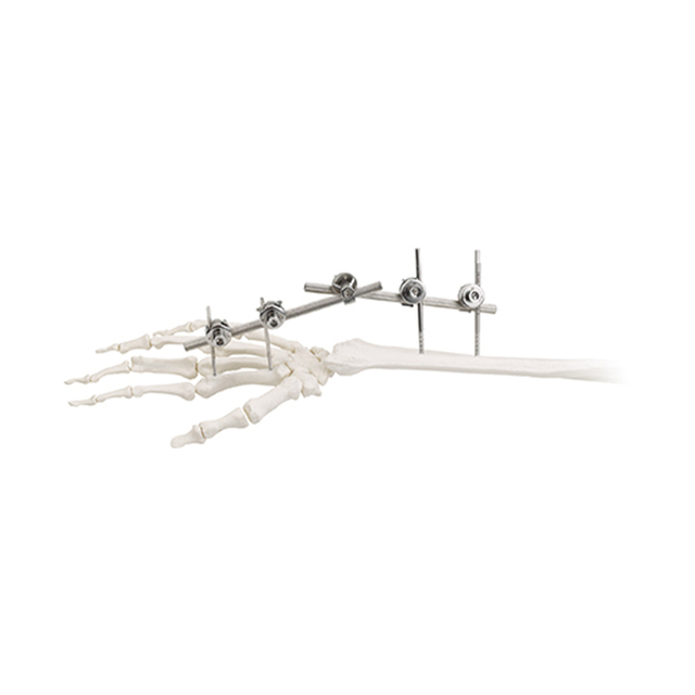 Wrist Joint External Fixator 9100-1501