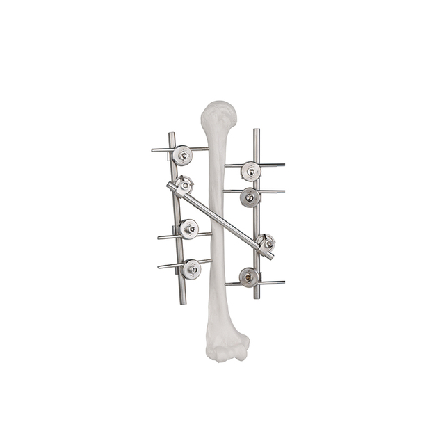 Humeral Frame External Fixator