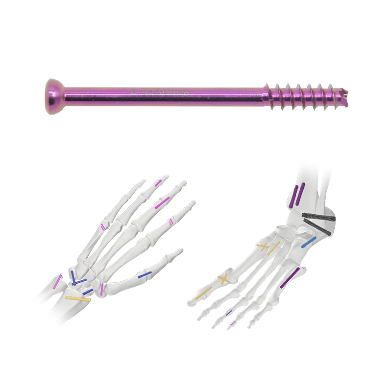 Herbert Cannulated Compression Screw