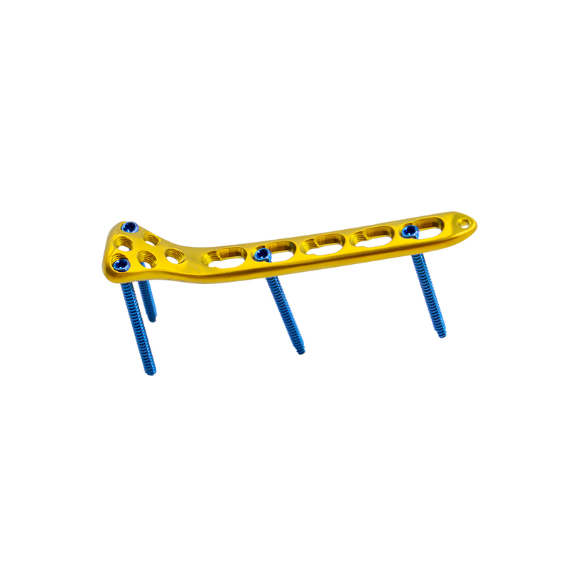 Proximal Radius Locking Plate