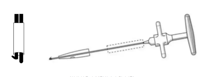 Broken cannulated intramedullary nail removal