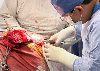 cranioplasty-surgery-titanium-mesh-mexico-01-czmeditech