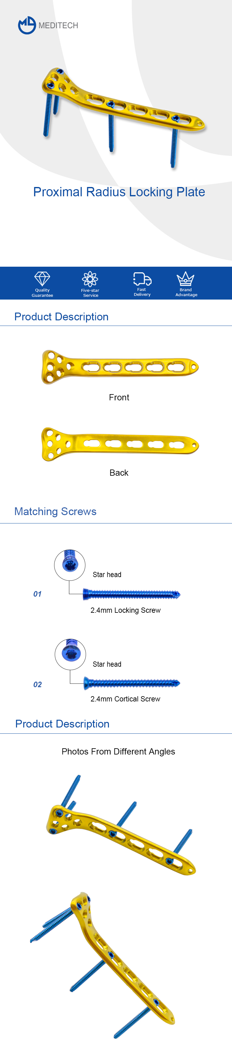 Proximal Radius Locking Plate 