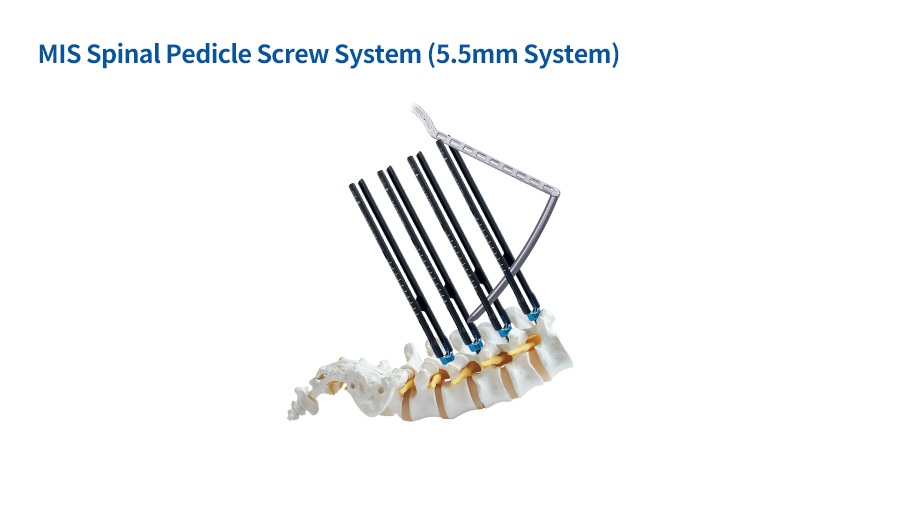 MIS Spinal Pedicle Screw