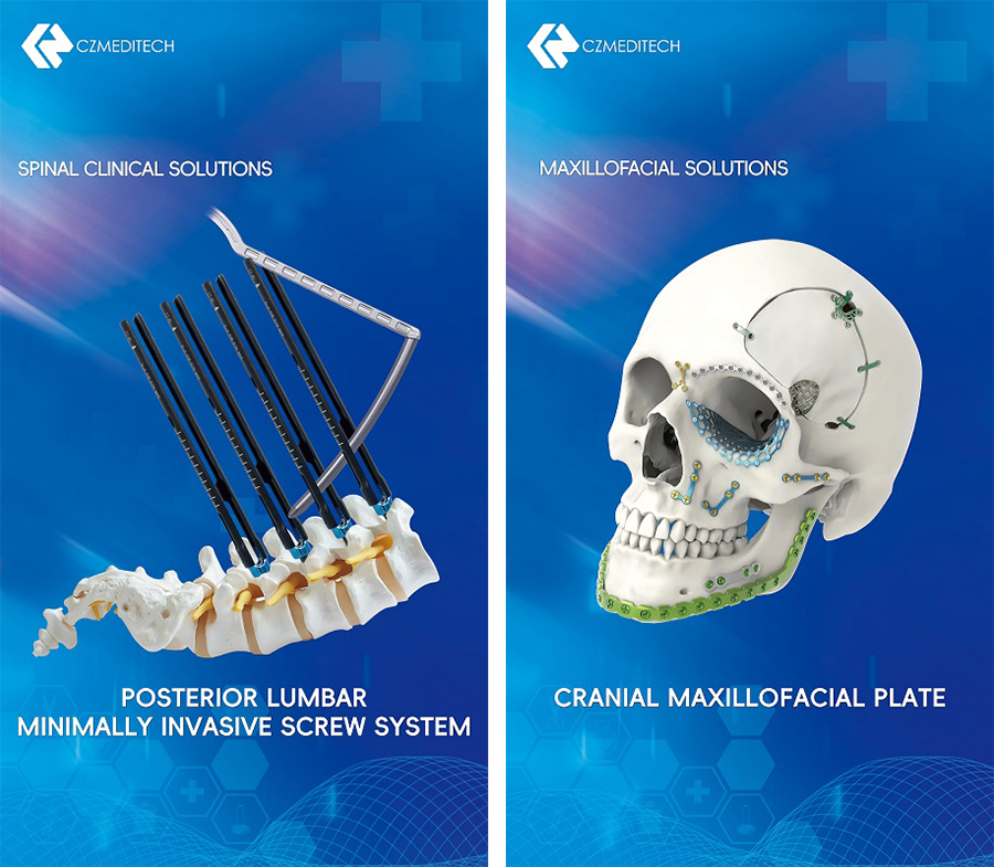 Orthopedic Implants
