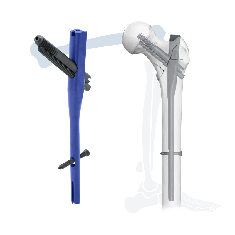 Anterior Cervical Spine Fixation System