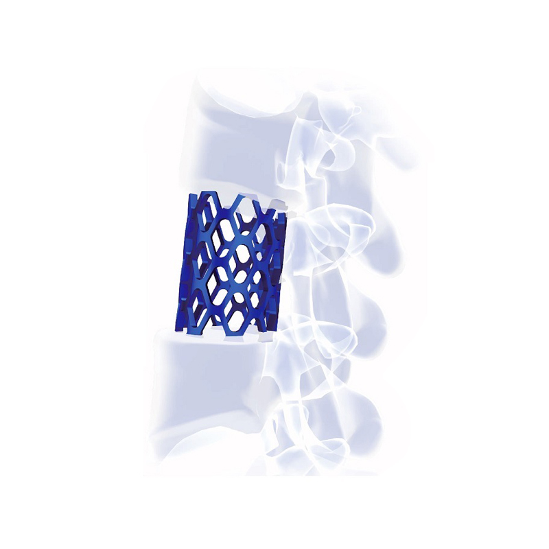 Titanium Mesh Cage