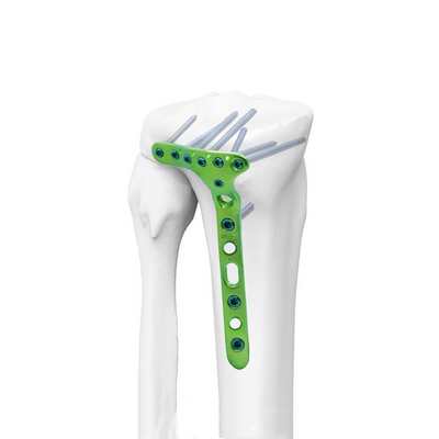 Distal lateral tibial bloke plak-II