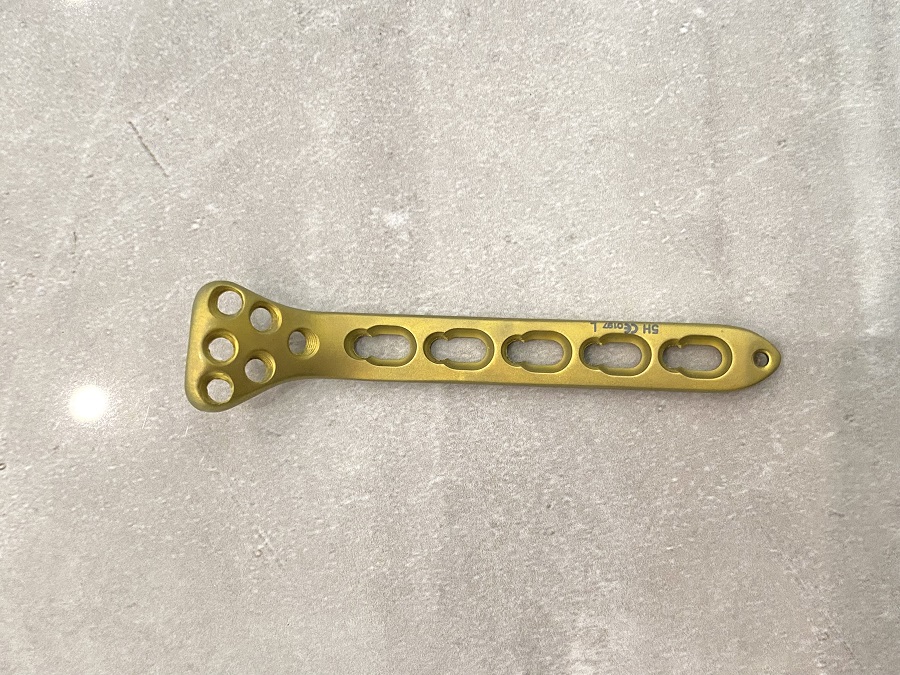 Proximal Radius Locking Plate