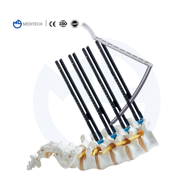 Missin spinal spiclation Nidaamka Turn (Nidaamka 5.5mm)