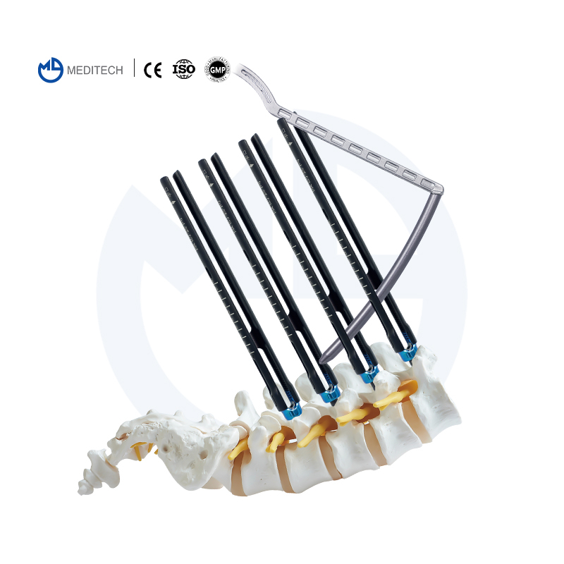 MIS Spinal Pedicle Screw System(5.5mm System)
