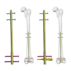 DFN Distal Femur Intramedullary Nail T1100-46