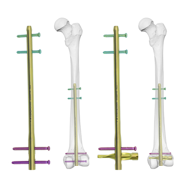 DFN Femur Distal UNIF INTAMAMELARY T1100-46