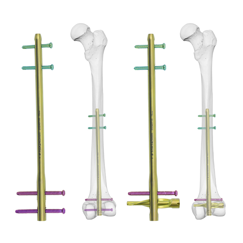DFN Distal Femur Intramedullary Nail T1100-46