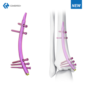 Distal Tibial Intramedullary Nail (DTN)