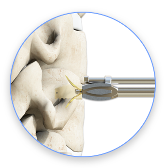 ACEF UNI-C Standalone cervicale kooi (steriliseer) 产品介绍图
