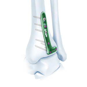 VA distale tibia-sluit L-plaat