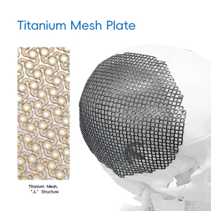Titanium Mesh, "Λ" Structure