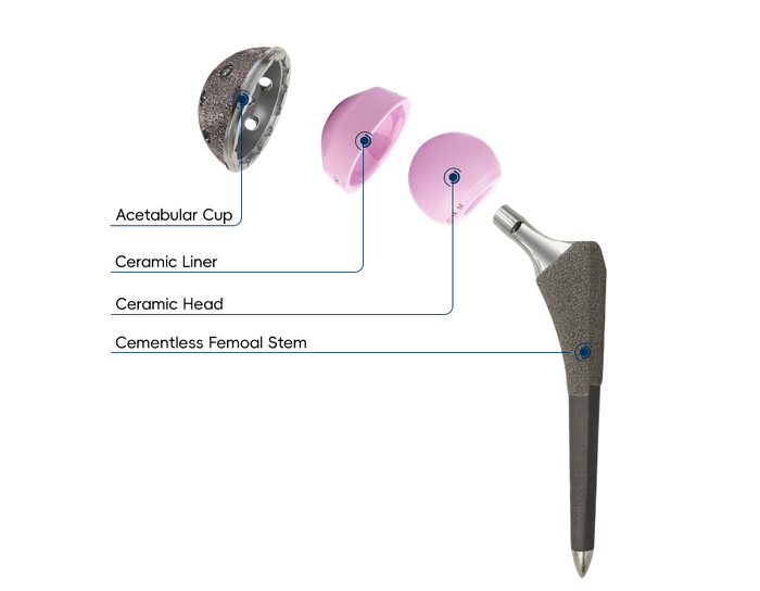 Hip System