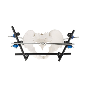 Pelvic Fixator External Fixator