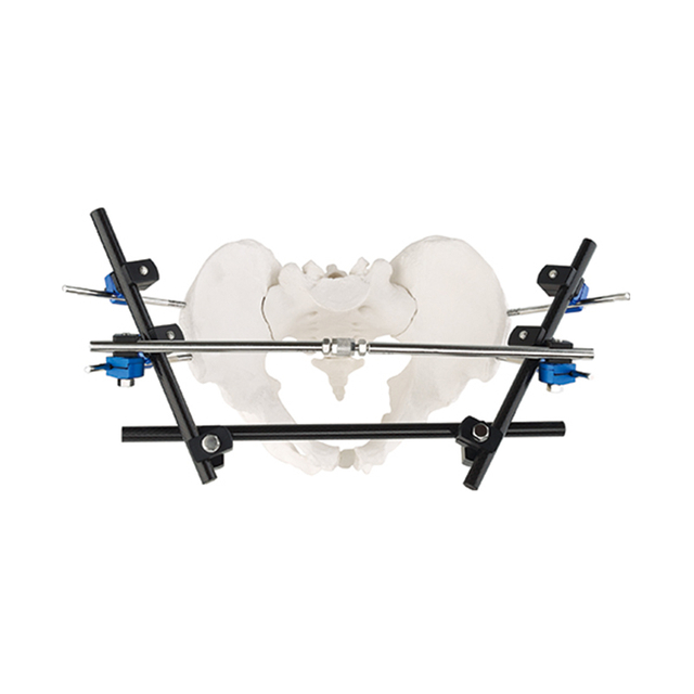 Pelvic Fixator External Fixator